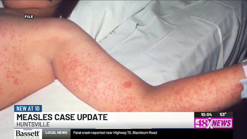The Alabama Department of Public Health says 195 contacts have been identified across...