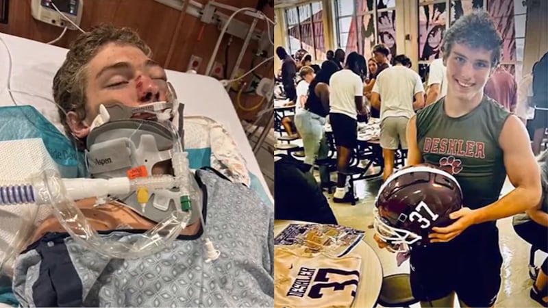 August Borden’s mom and stepdad posted on social media that their son was severely injured at...